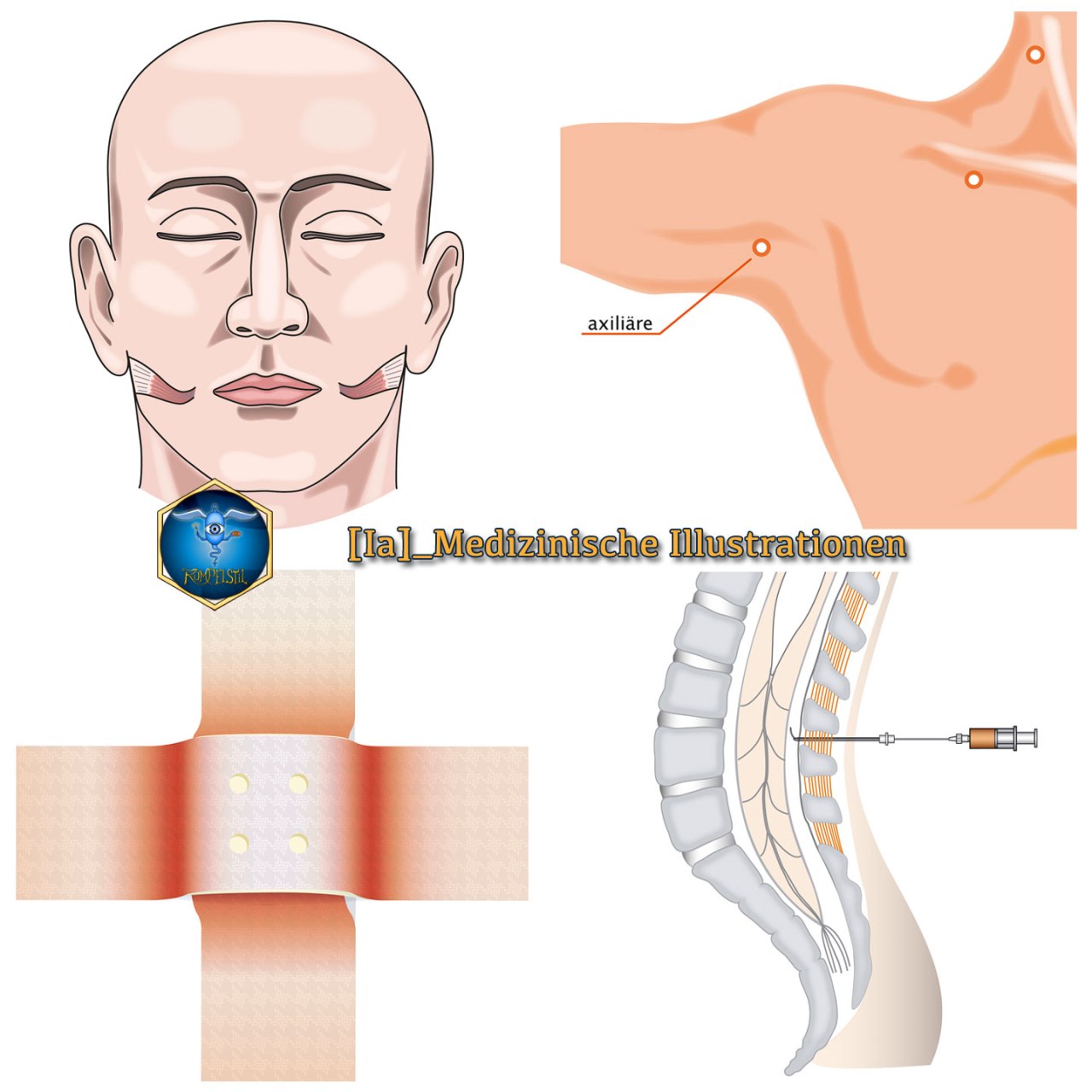[Ia]_Illustrationen Med